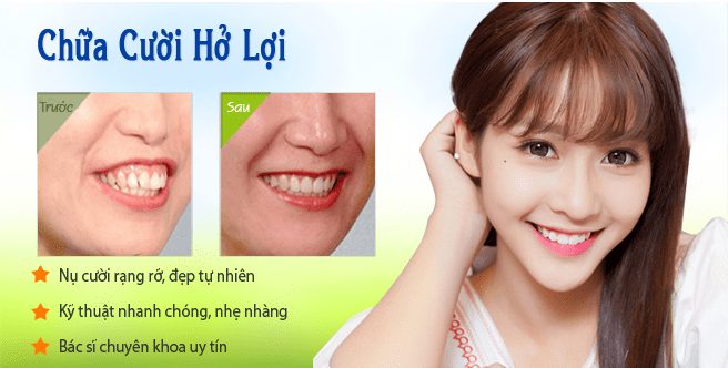 Mang đến nụ cười rạng rỡ 1 cuoi rang ro