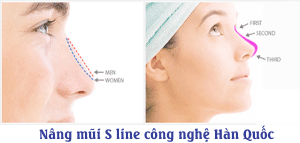 nang mui s-line