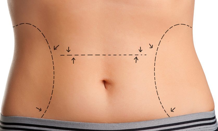 Dịch vụ Thẩm mỹ 4 Debunking Body Cosmetic Surgery Myths