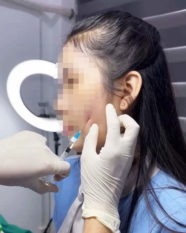 Thẩm mỹ chui cấp tốc lại tung hoành bất chấp: Vấn nạn nhức nhối phải xử lý triệt để 3 tiem filler o co so tham my chuidu yen 17057645930371459761994