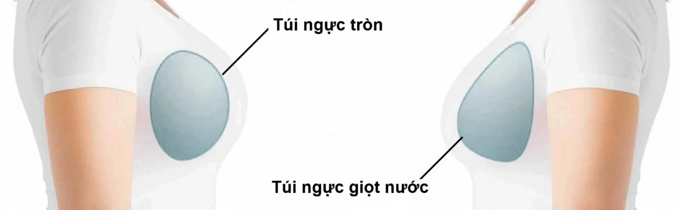 Hình dạng túi ngực