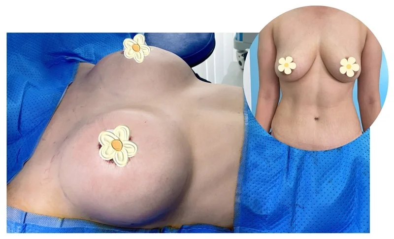 Nhan mi mat