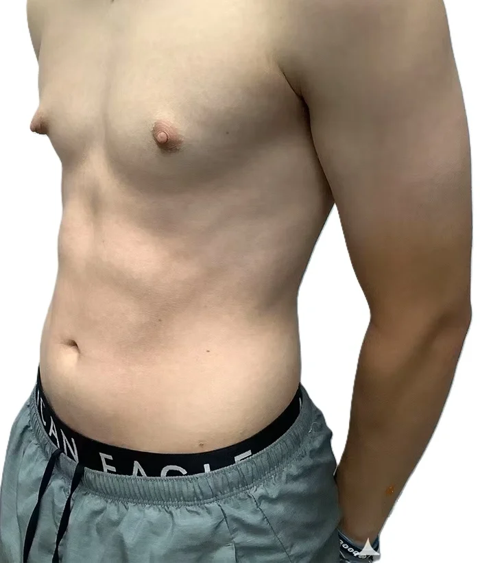 BỘ NGỰC 10 vung kin
