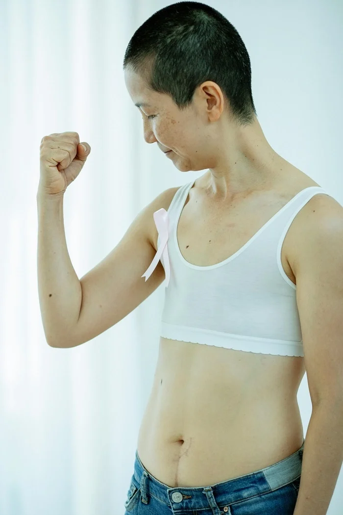 TÁI TẠO NGỰC 5 Khách hàng - Sửa mắt và mũi