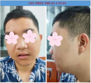 Bệnh nhân sau ca mổ